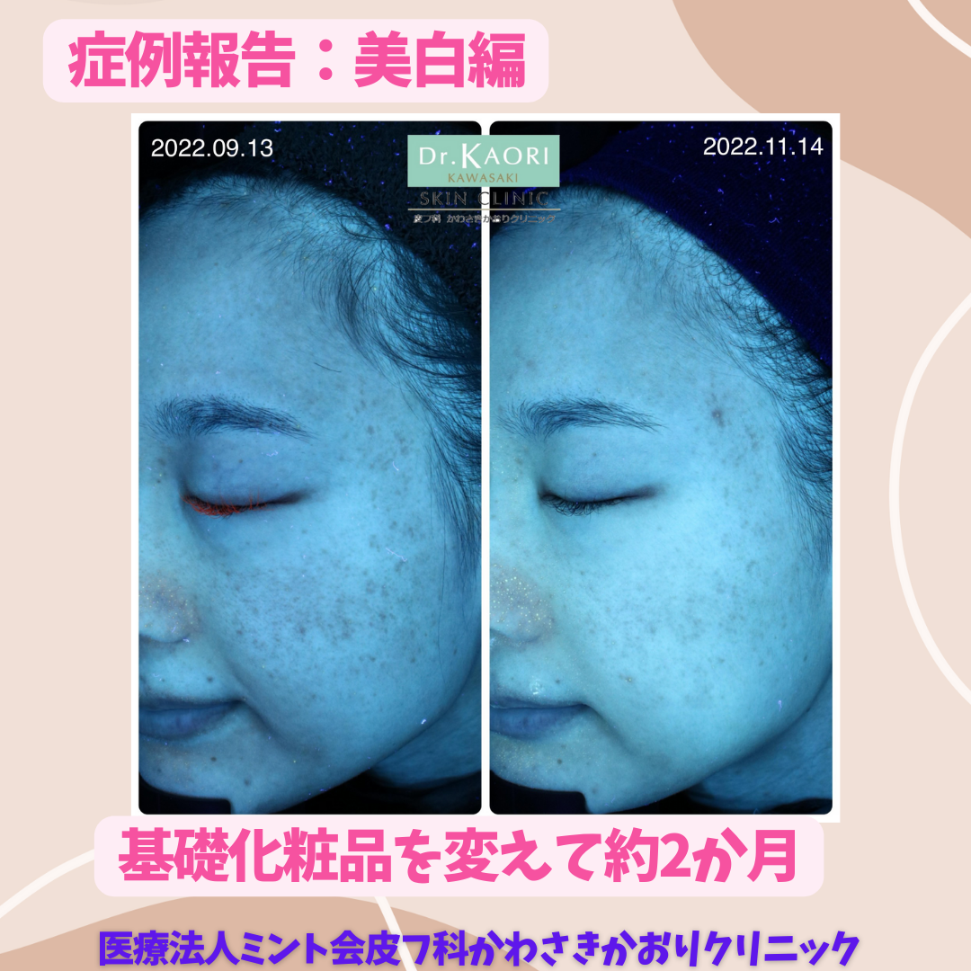 ジャンマリーニ スタッフが使ってみた報告です!!